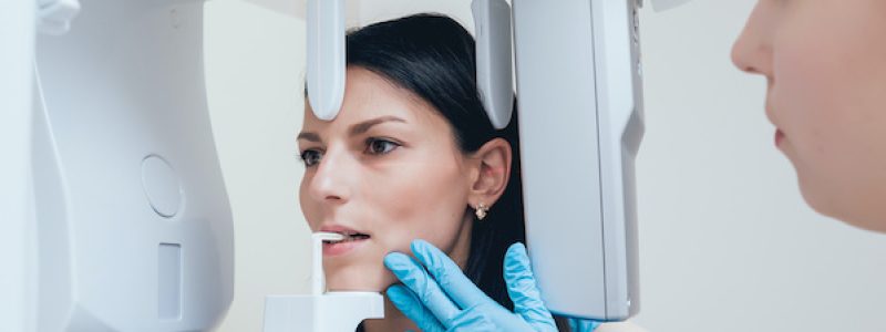 dental-x-rays