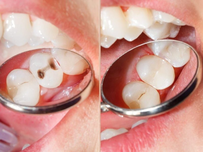 resin resin